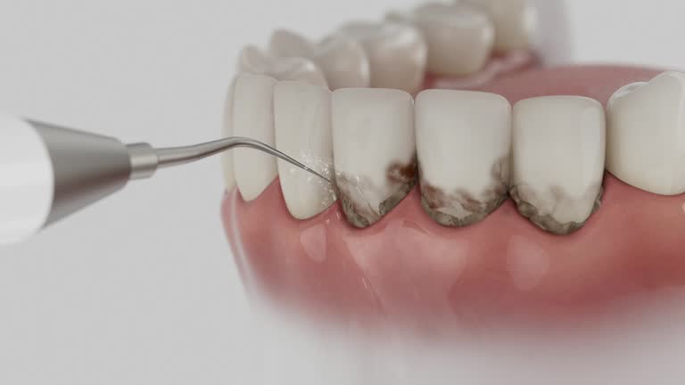 Reliable Wisdom Tooth Removal contractor in Cleburne County County, AL by Dentist Open Now